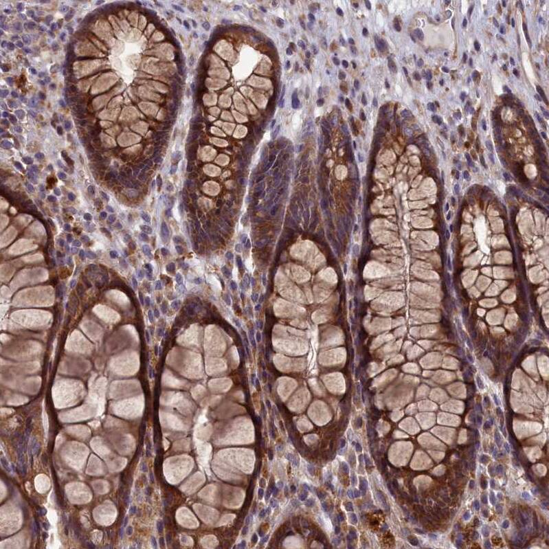 Staining of human rectum shows strong cytoplasmic positivity in glandular cells.